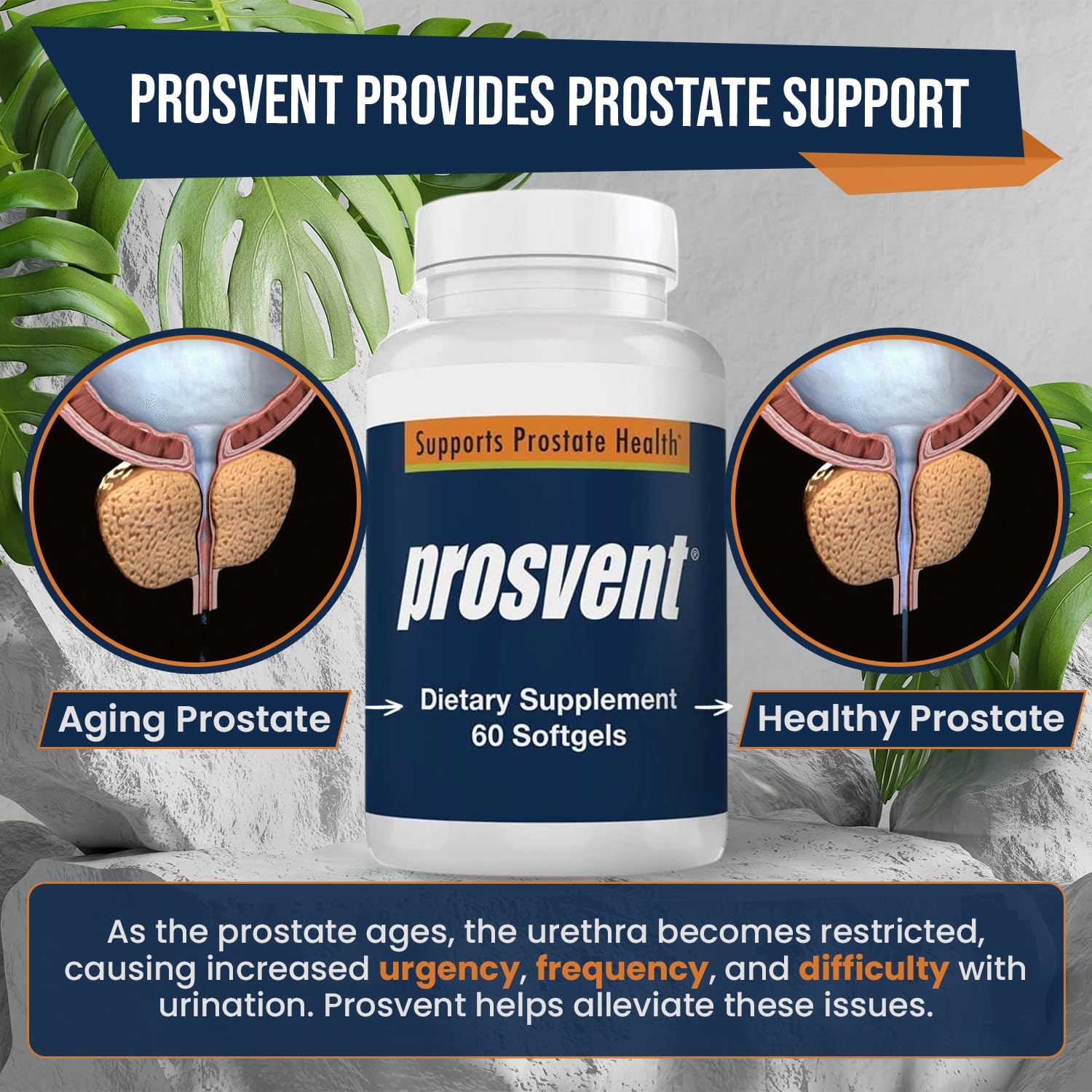 Prosvent Advanced Men's Prostate Support Supplement