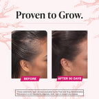 Viviscal Hair Growth Supplements For Women For Thicker, Fuller Hair 180 Tablets
